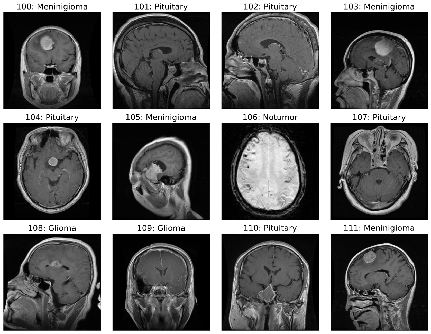 Sample Input MRI